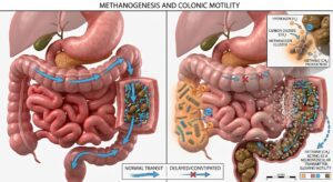 Gut Bacteria