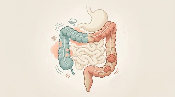 IBS-C vs Chronic Constipation