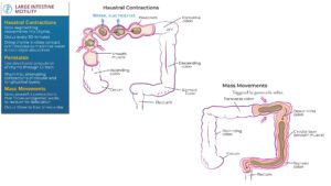 stress often speeds the colon up